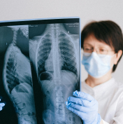 A person wearing a mask and gloves examines two chest X-rays.